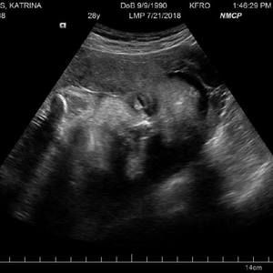 Meet your Posher, Katrina